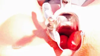 Elouise Please Speculum Study